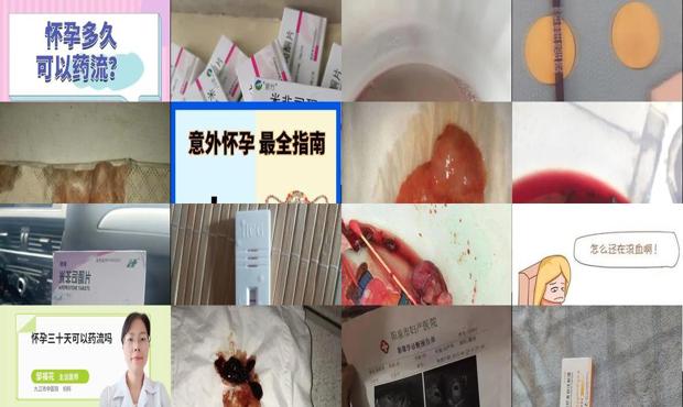 汕头刚发现怀孕可以药流吗