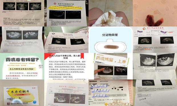 汕头药流不干净清宫会怎样