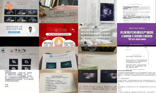 汕头怀孕几天不能用药流