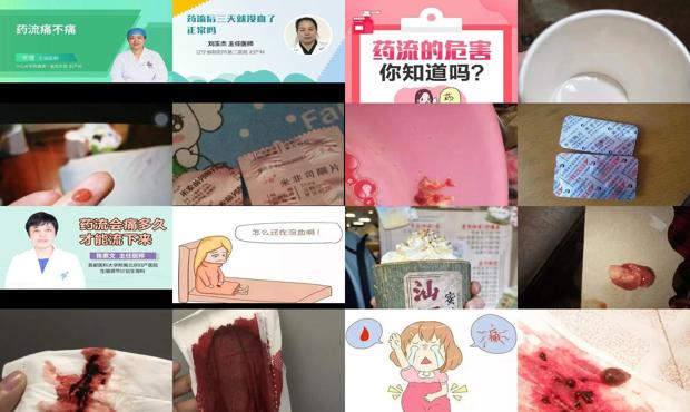 汕头药流会不会很痛