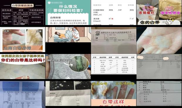 汕头白带异常怎么检查
