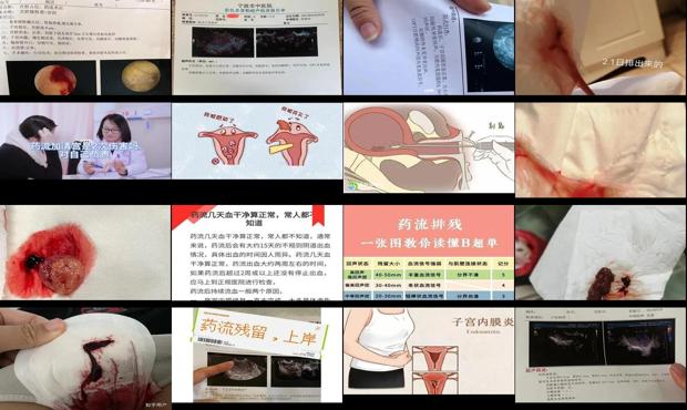 汕头药流后清宫的危害