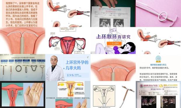 汕头放环会宫外孕吗