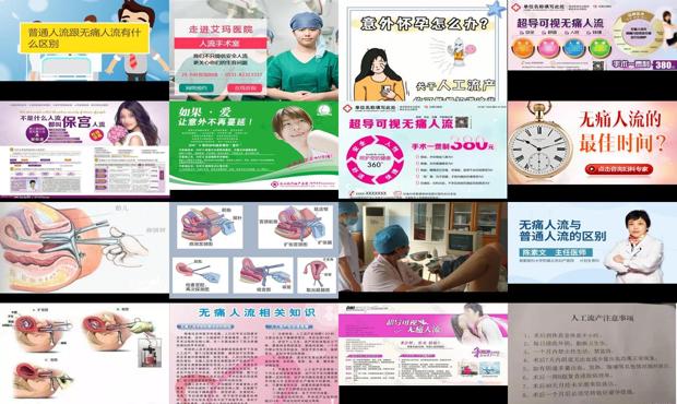 汕头*人流跟普通人流区别