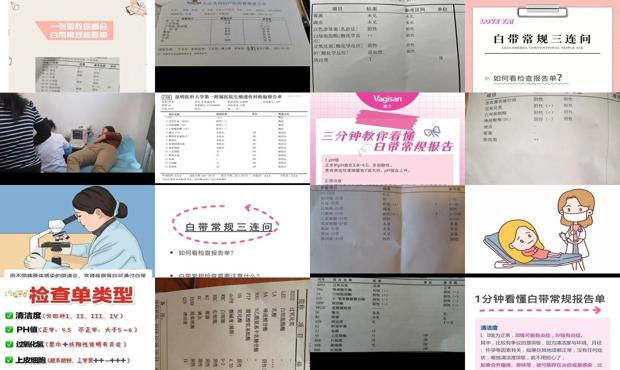 汕头白带常规检查怎么做