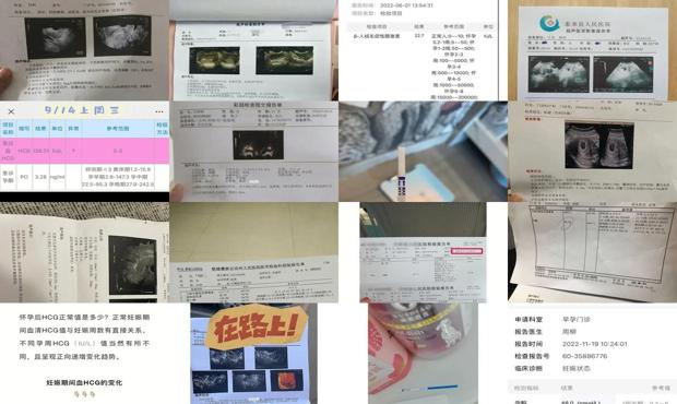 汕头hcg可以查出宫外孕吗