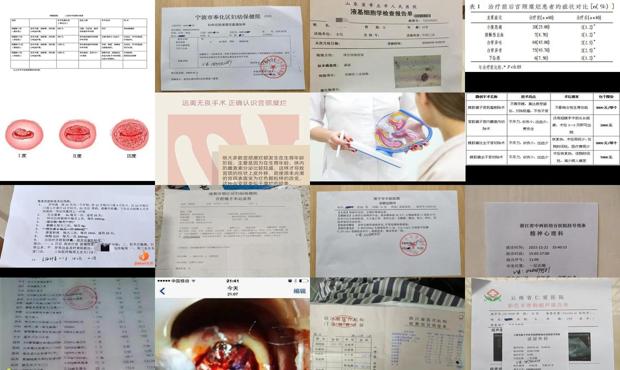 汕头宫颈糜烂手术价格表