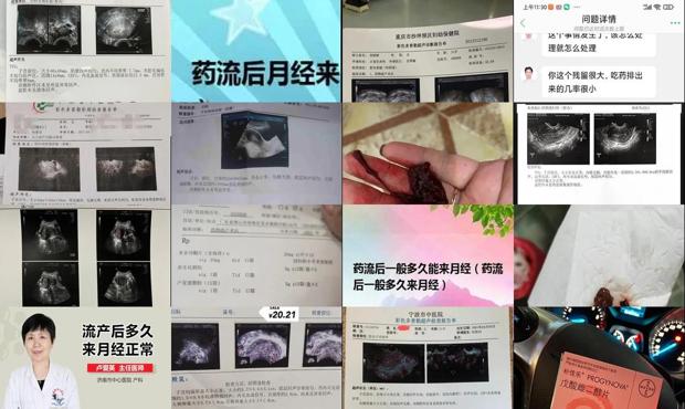 汕头药流后多久来月经正常