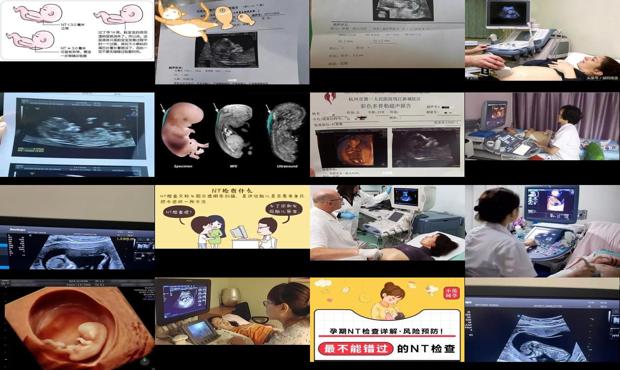 汕头nt检查是什么
