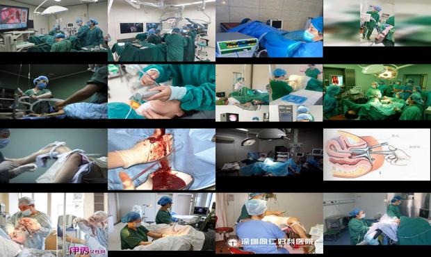汕头什么是*人流手术