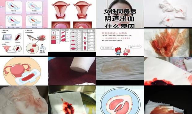 汕头怎么玩 - 汕头怎么判断是例假血还是宫颈出血