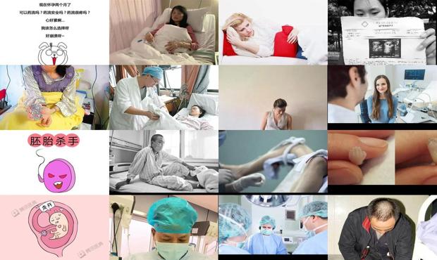 汕头怀孕2个月还能做流产吗