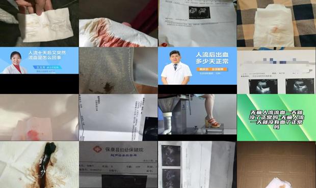 汕头做完*人流后没有血