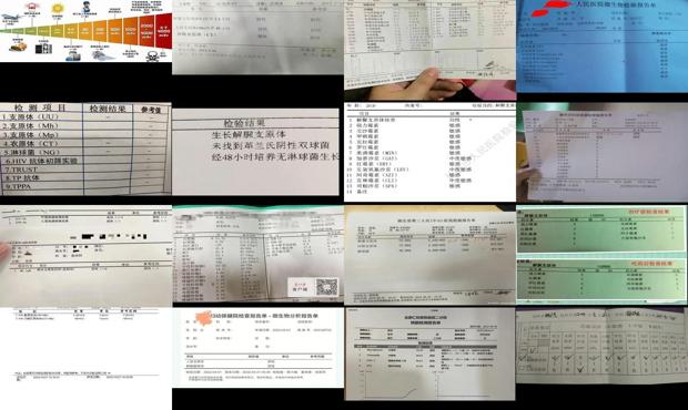 汕头支原体如何检查