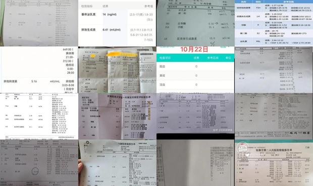 汕头六项激素检查是什么