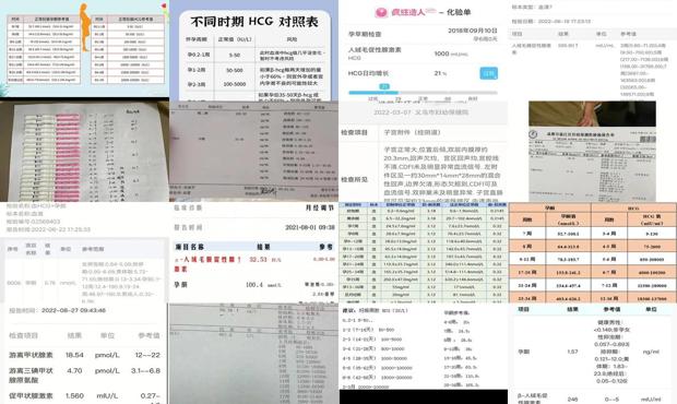 汕头宫外孕查血hcg范围
