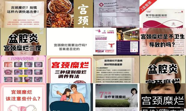 汕头宫颈糜烂怎么治疗*好