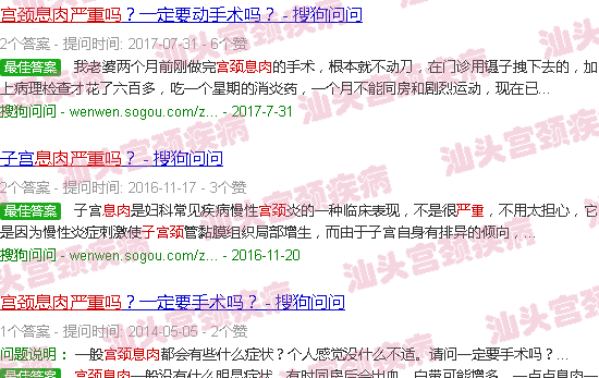 汕头宫颈息肉严重吗