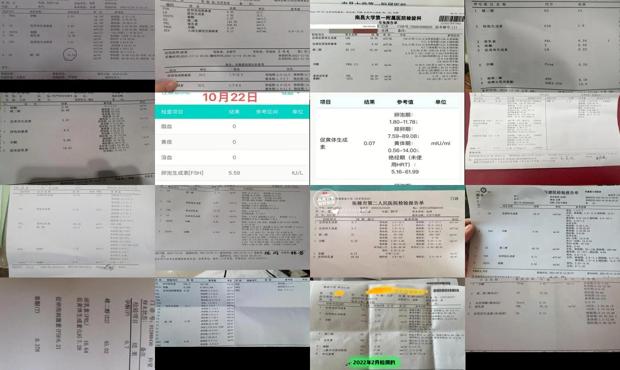 汕头女性雌激素六项检查