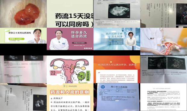 汕头怀孕15天可以药流吗