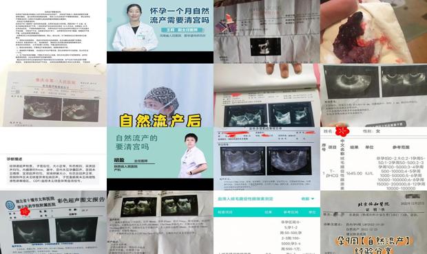 汕头自然流产还用清宫吗
