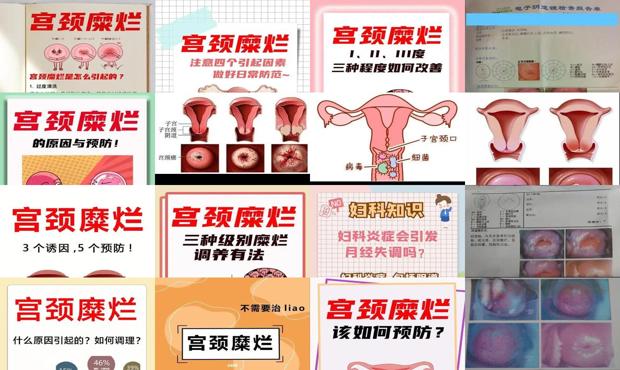 汕头宫颈糜烂会导致月经不调吗
