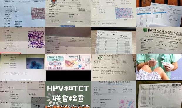 汕头宫颈tct检查是什么