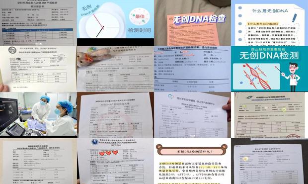 汕头*dna是检查什么的