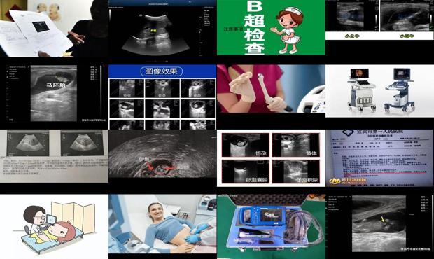 汕头b超检查子宫附件