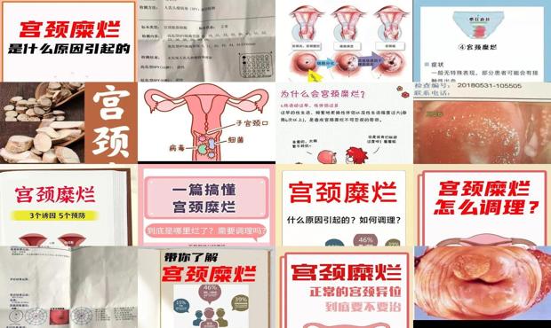 汕头宫颈糜烂是什么引起的