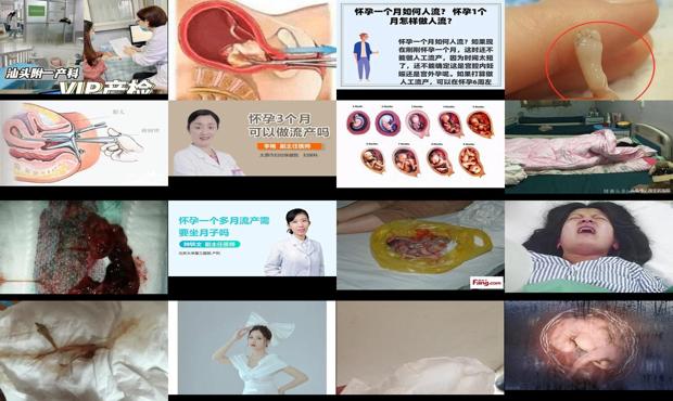 林州怀孕六个月 - 汕头怀孕6个月可以流产吗