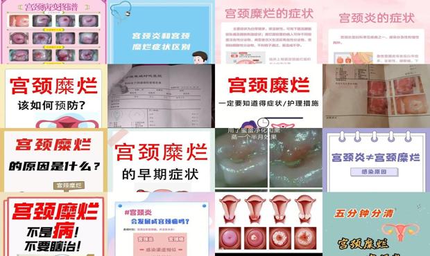 汕头宫颈炎和宫颈糜烂有什么区别
