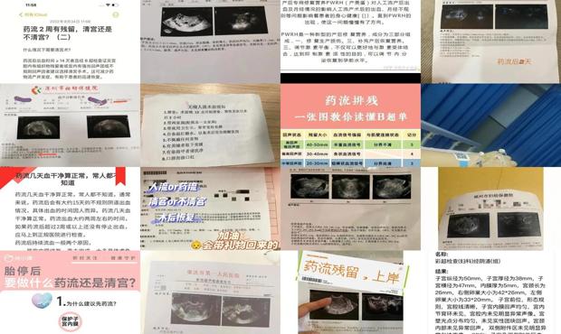 汕头药流不*清宫*佳时间