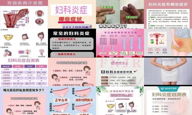 汕头急性妇科炎症症状表现