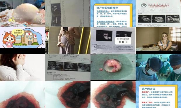 汕头怀孕三个月产假多少 - 汕头怀孕三个月能流产吗
