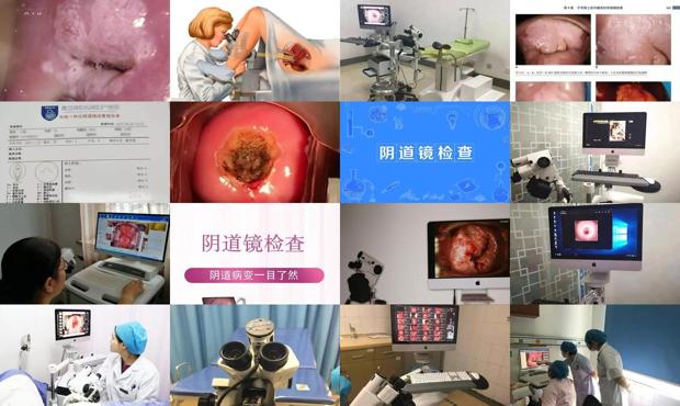 汕头阴到镜能检查出什么