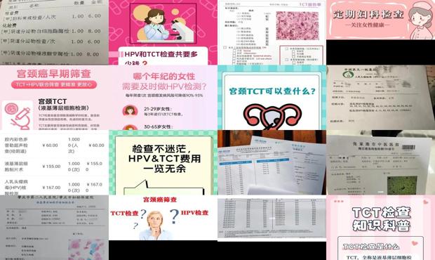 汕头宫颈tct检查多少钱