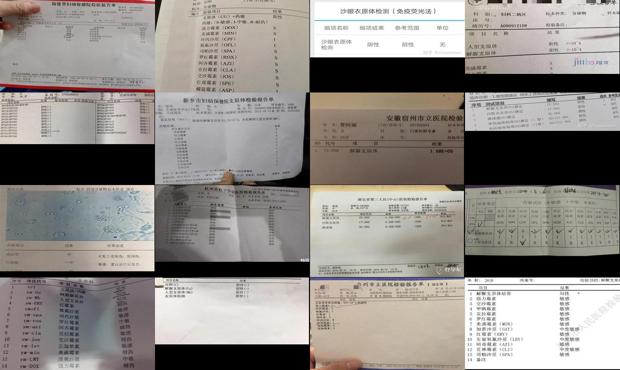 汕头妇科支原体检查什么