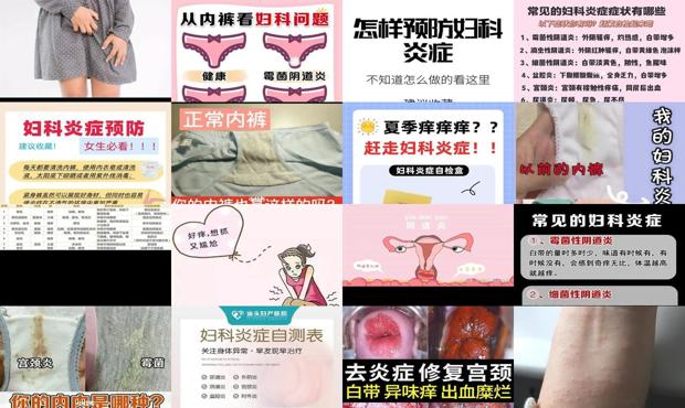 汕头妇科炎症有哪些症状痒