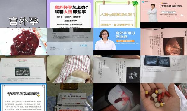 汕头宫外孕吃药流