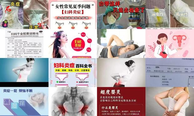 汕头右侧腰酸是妇科炎症吗