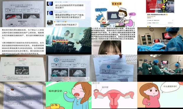 宫外孕可以打掉吗宫外孕打掉多少钱? - 汕头宫外孕去打掉要多少钱