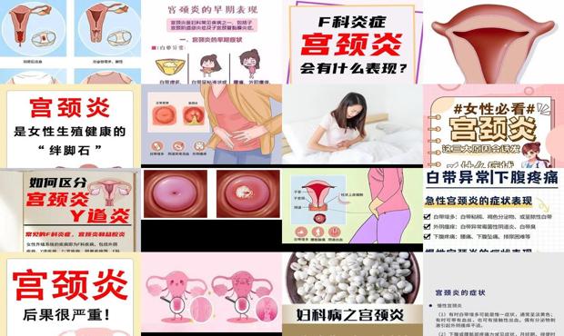 汕头宫颈炎的主要症状