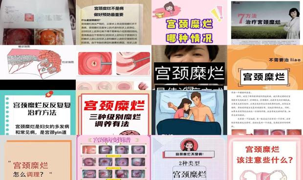 汕头宫颈糜烂怎么治疗除根