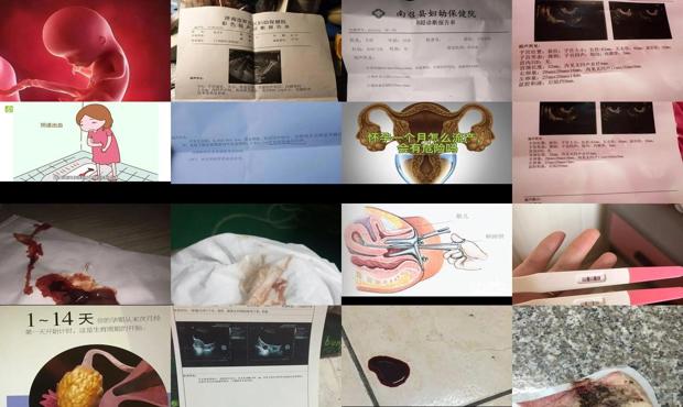 怀孕一个月怎么打胎 - 汕头怀孕一个月流产的症状