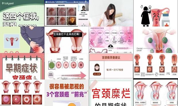 汕头宫颈疾病早期症状