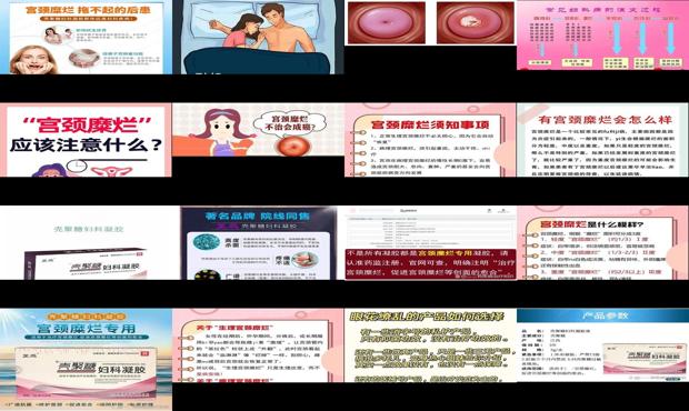汕头治宫颈糜烂的医院 - 汕头治宫颈糜烂多少钱