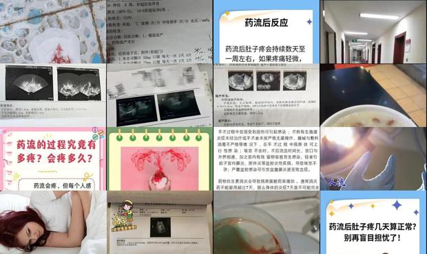 汕头做药流疼吗