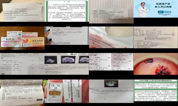 汕头药流吃药后多久有反应