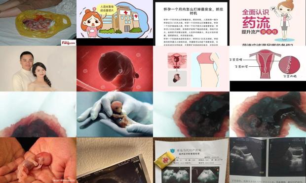 我说我现在怀孕三个月 - 汕头怀孕3个月可以流产吗